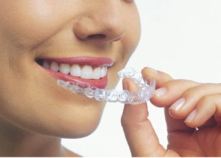 Ivy League Dental | Englishtown Dentist | Dentist in Marlboro NJ | Invisalign