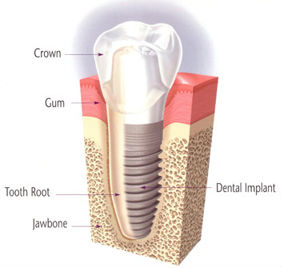 Ivy League Dental | Englishtown Dentist | Dentist in Marlboro NJ