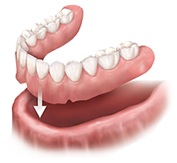 Ivy League Dental | Englishtown Dentist | Dentist in Marlboro NJ | Dentures
